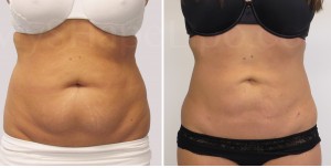 B-A-ONLY-photos-cr-U-L-LH-HIPS-SL46W-L-from-front-JN-3-mo